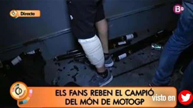 Vistosa fasciatura sulla gamba di Lorenzo fonte: telecinco.es